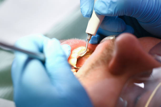 Best Emergency Denture Repair in Kiefer, OK