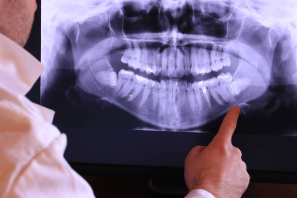 Best Emergency Treatment for Dental Infections or Abscesses in Kiefer, OK