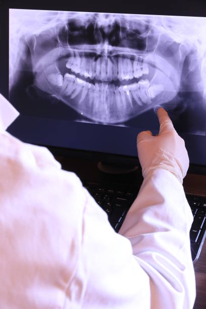 Best Emergency Treatment for Dental Infections or Abscesses in Kiefer, OK